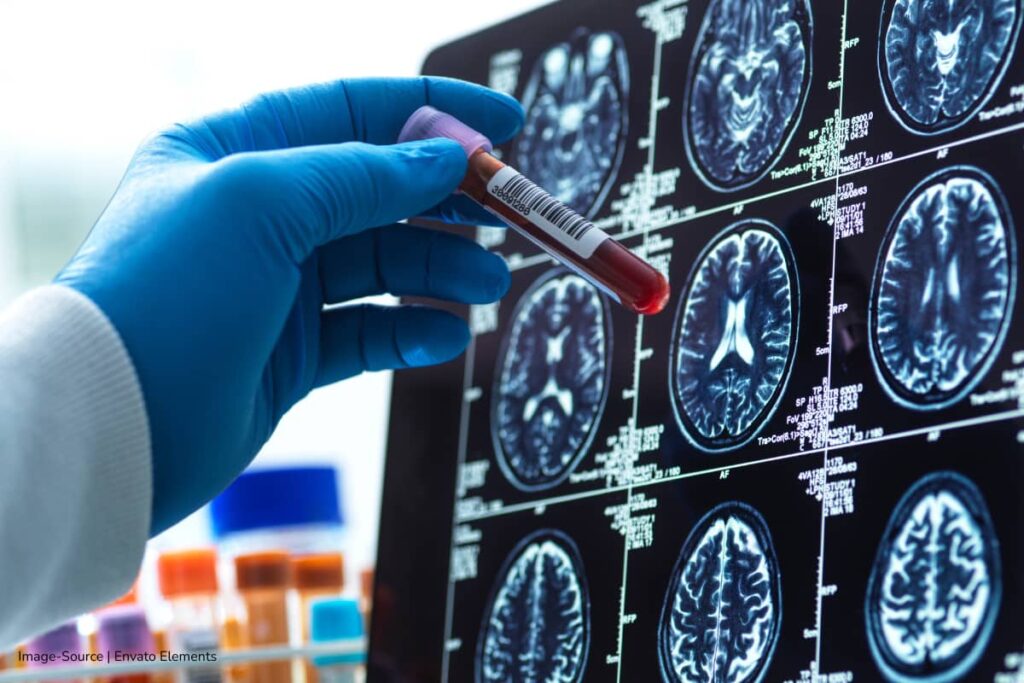 infecciones por hongos, El reto de la toxicidad y la administración, Más Tecnología